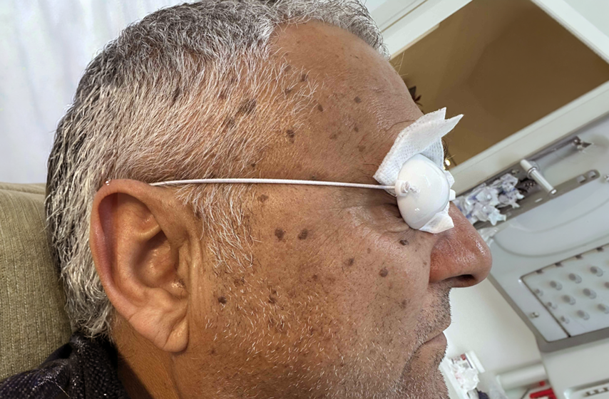 טיפול בכתמי גיל