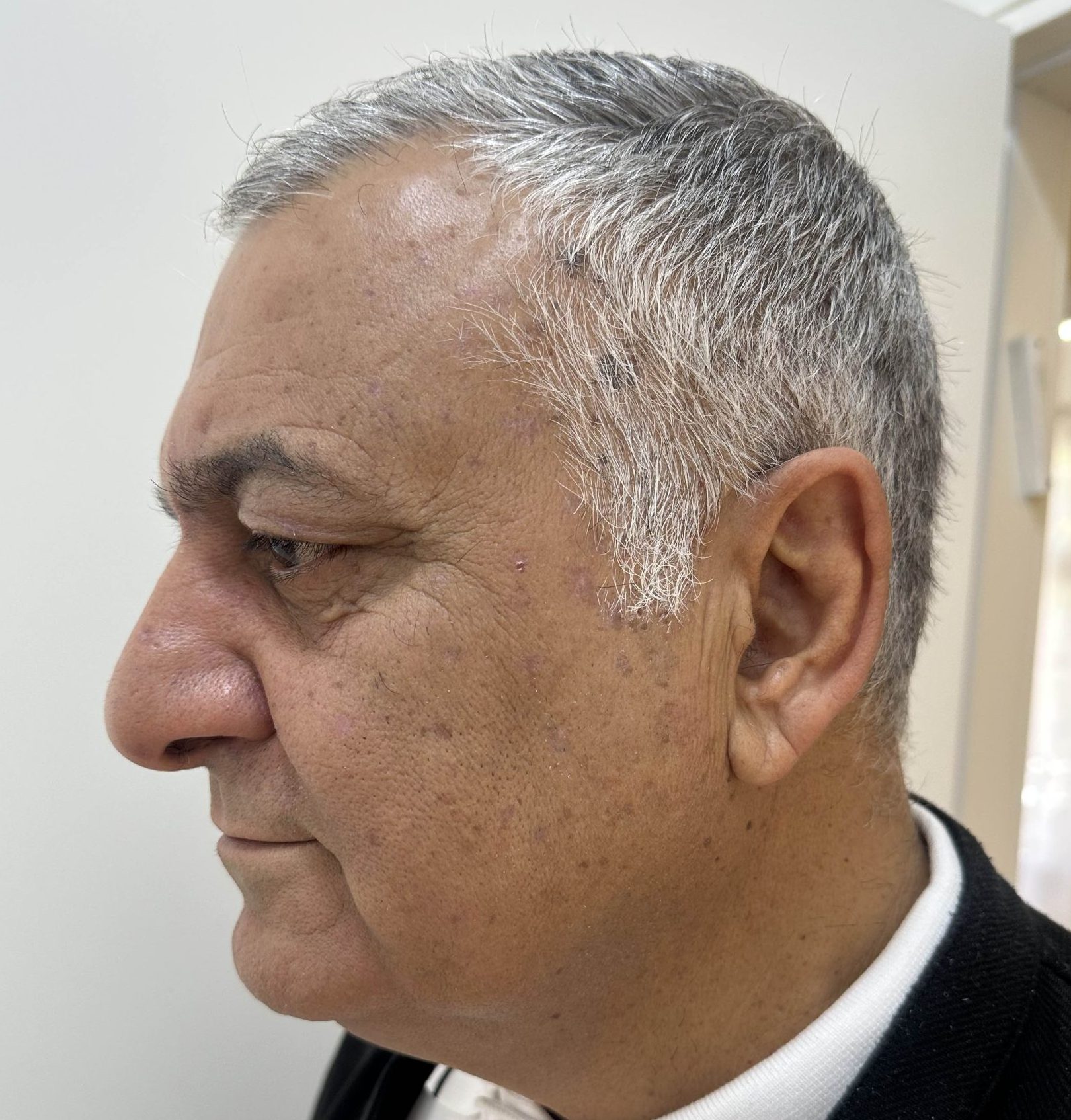 אחרי
