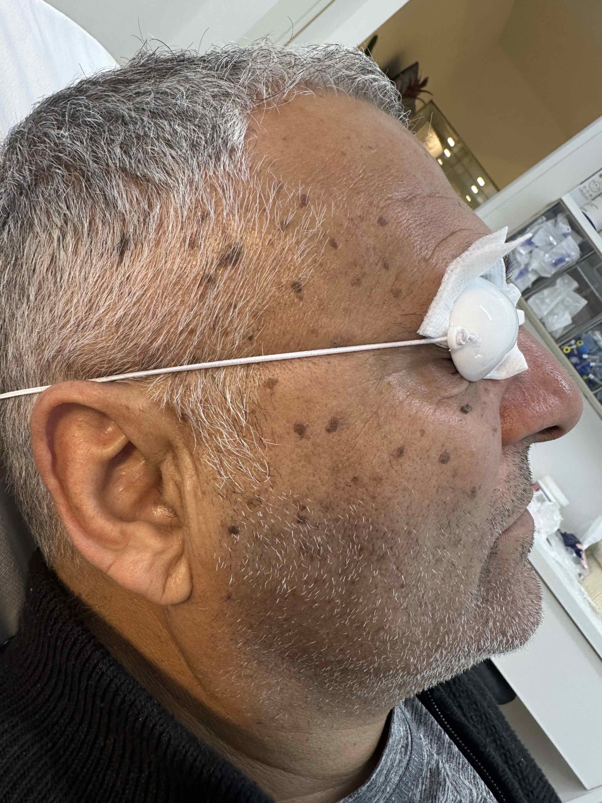 לפני