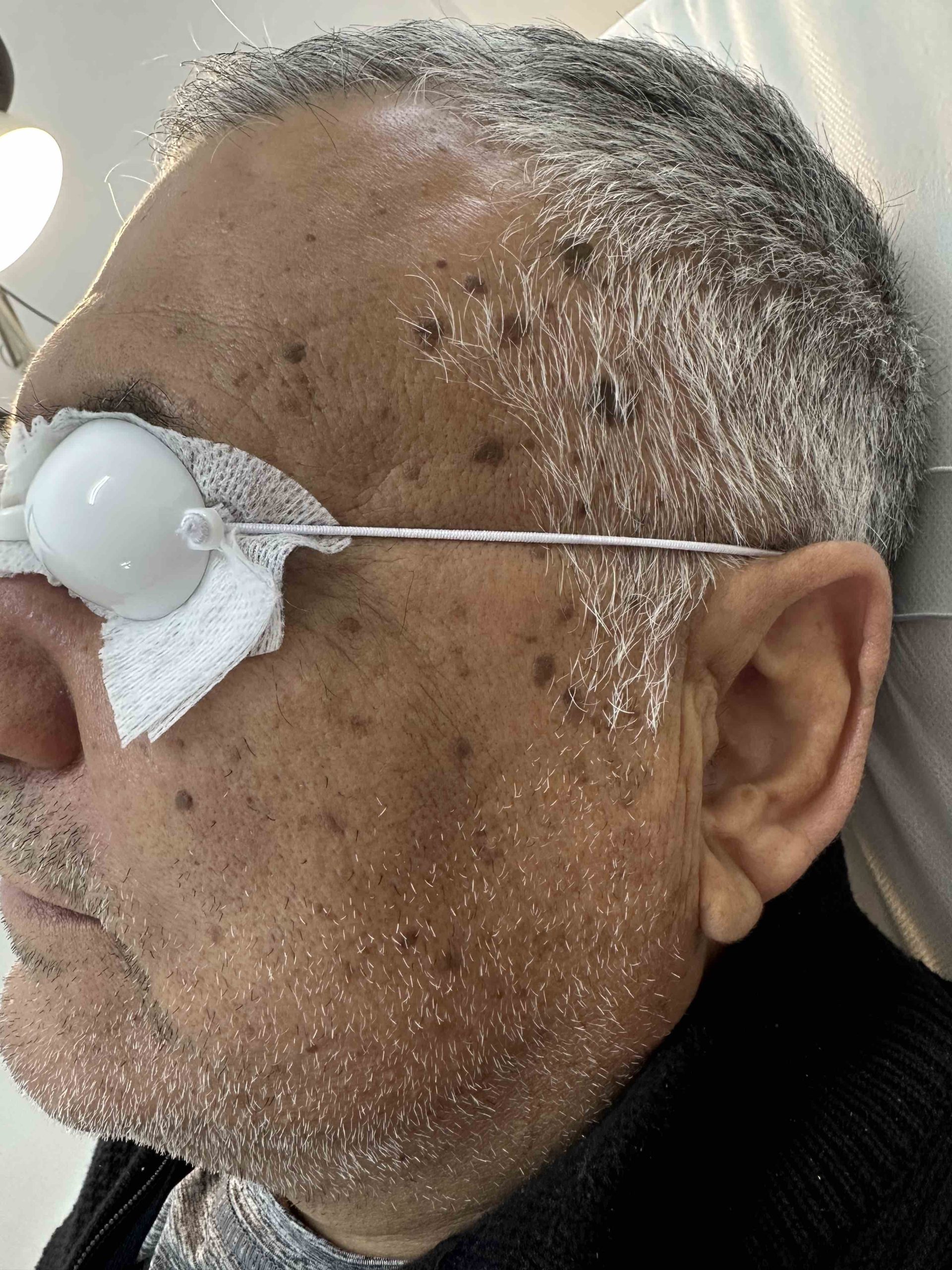 לפני
